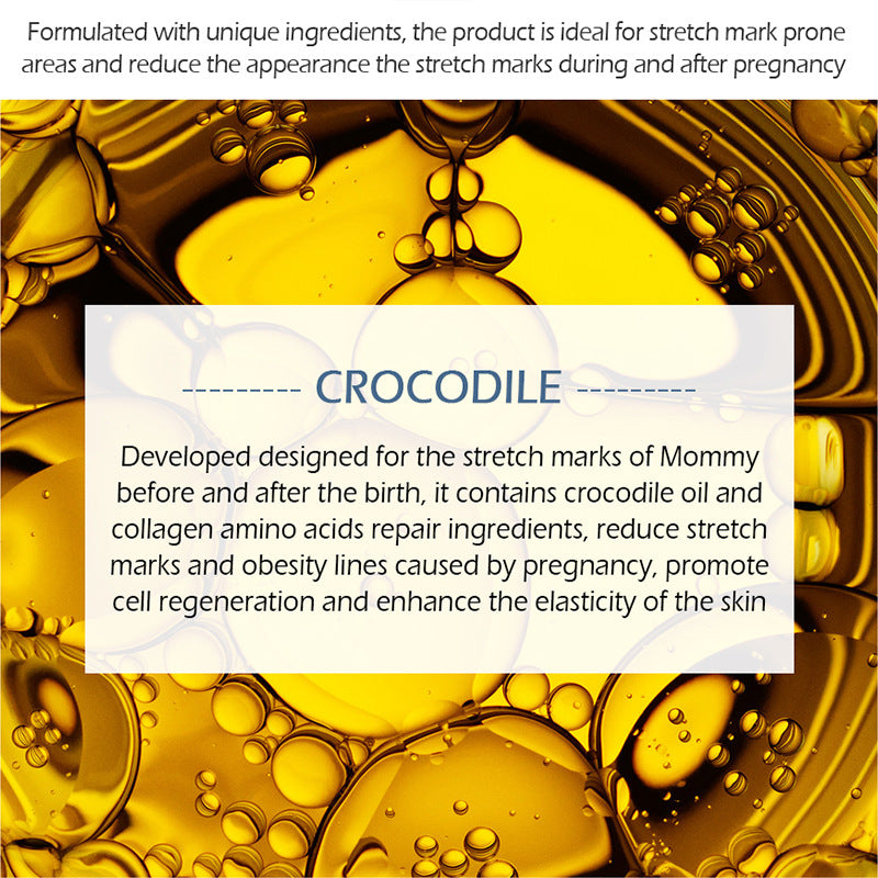 Natural cream improving skin scratch scar marks smooth skin stretch mark cream.