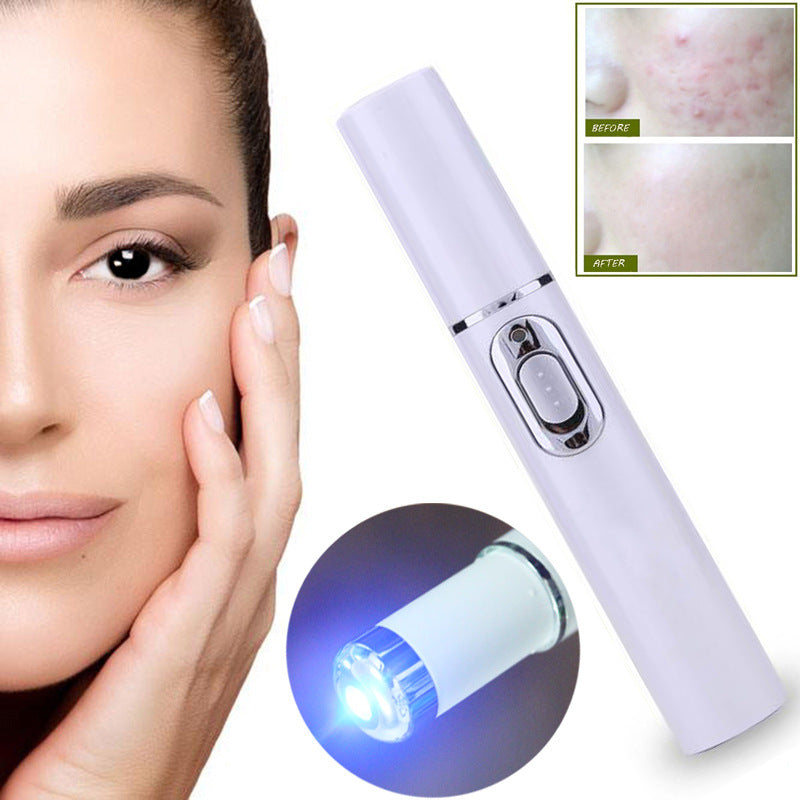 Blu-ray Electric acne removing pen to remove bags and dark circles under Eye Massager Beauty Eyes