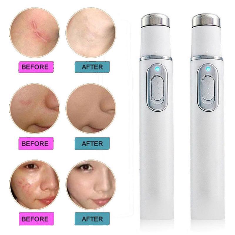 Blu-ray Electric acne removing pen to remove bags and dark circles under Eye Massager Beauty Eyes