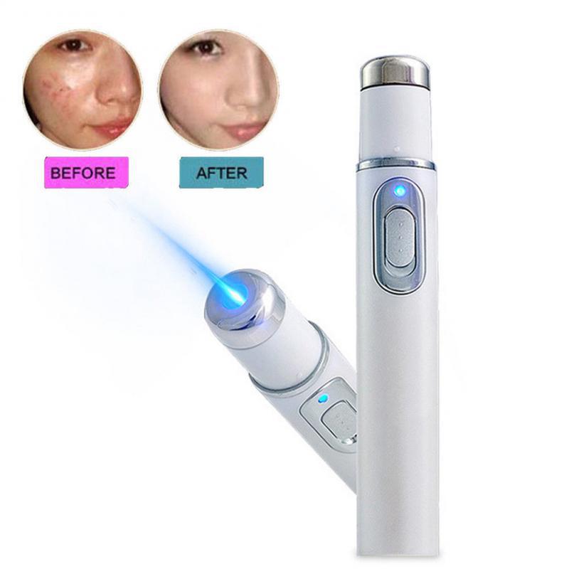 Blu-ray Electric acne removing pen to remove bags and dark circles under Eye Massager Beauty Eyes