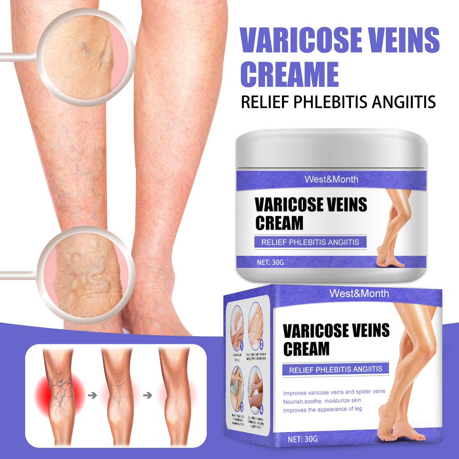 Cream vein cream earthworm leg blue veins bulge relieves pain red blood silk repair cream moisturizes legs