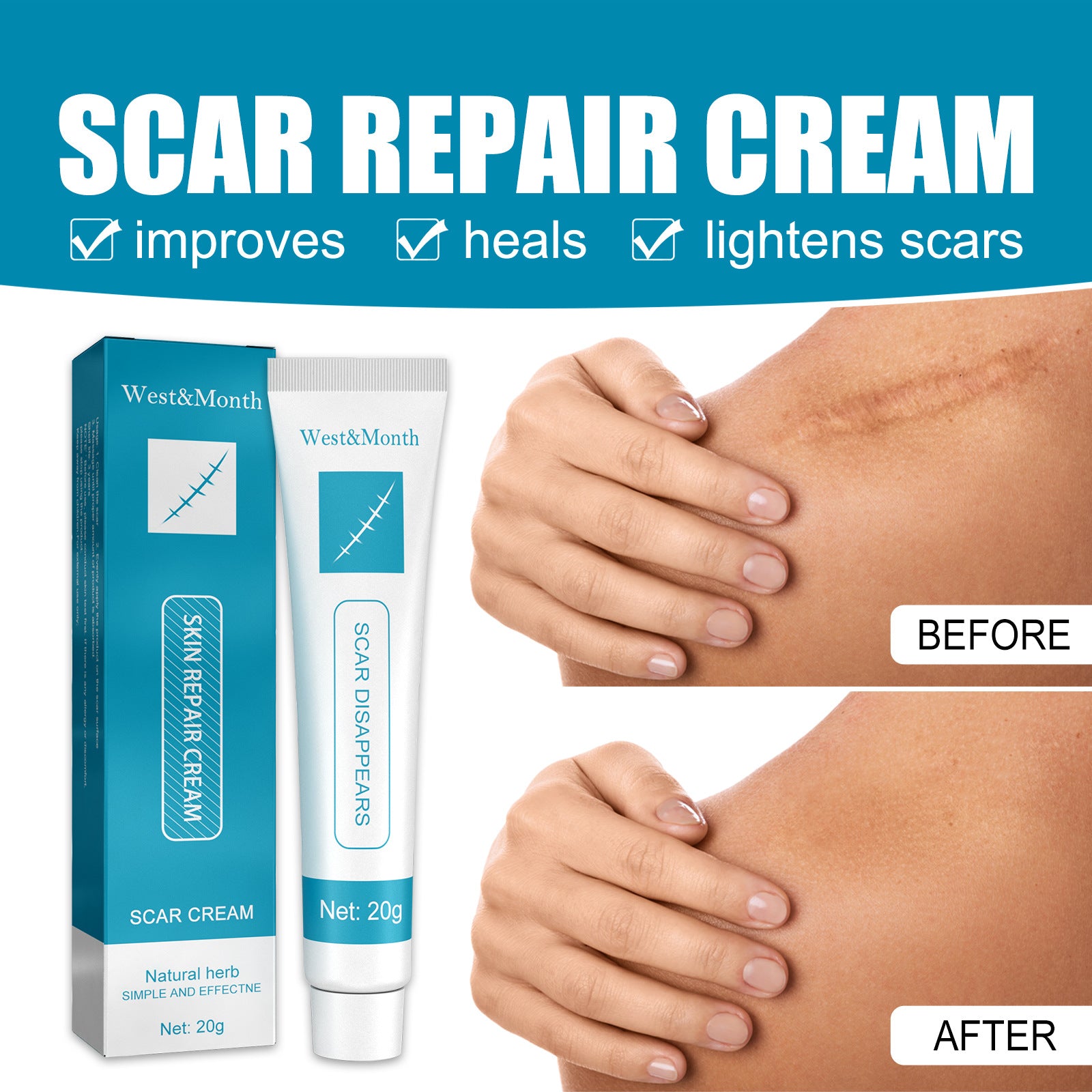 Natural cream scar repair cream scar cream fade hyperplasia pregnancy surgery burn scar skin repair