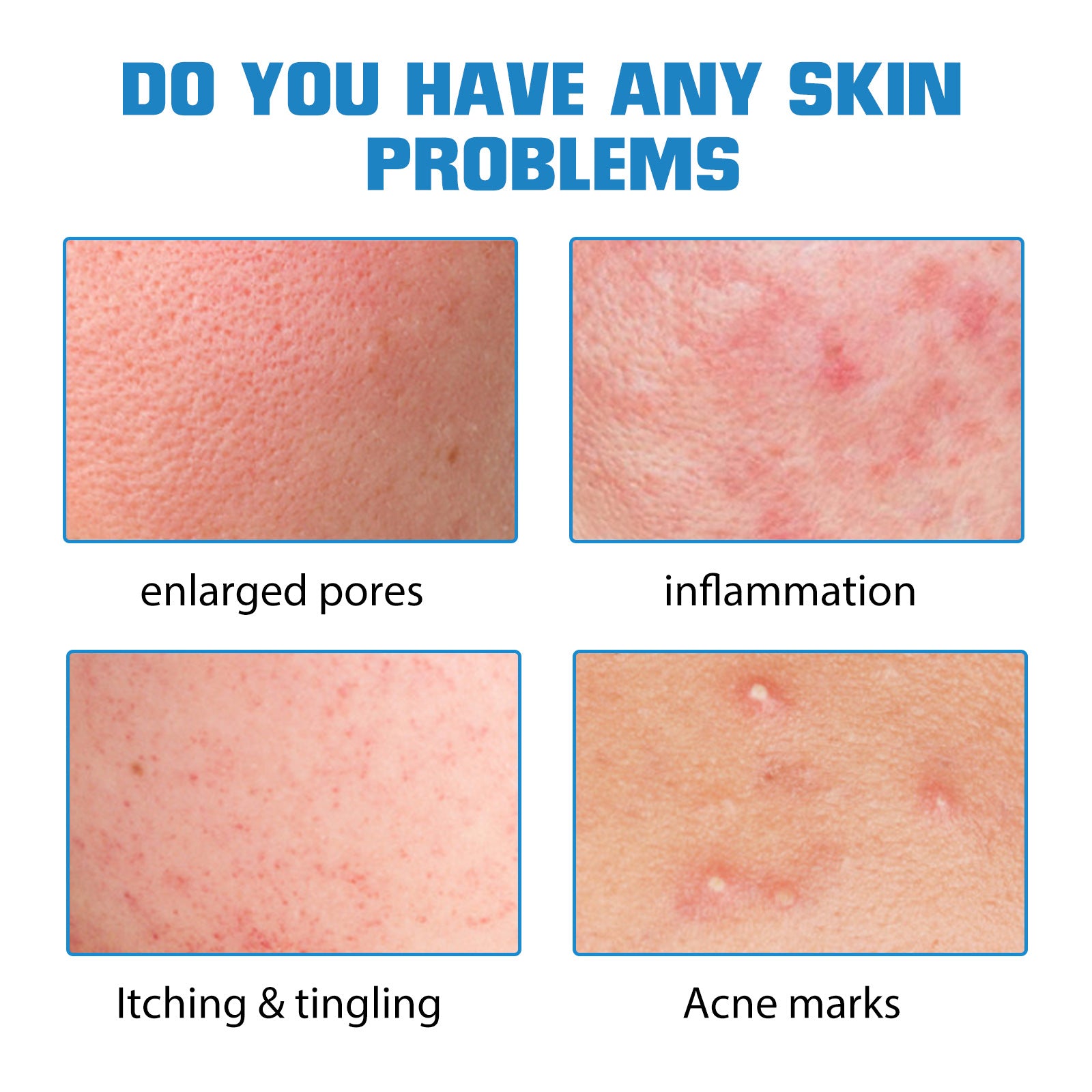 Hyaluronic Acid Essence Fades Facial Acne Marks, Hydrates, Repairs, Skin Care, Whitening Essence