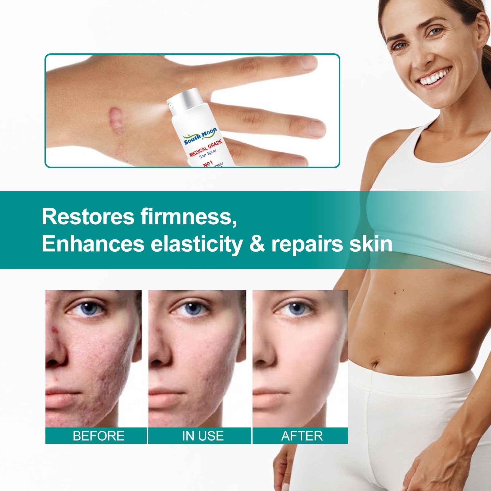 Scar removal Care Spray Lightens Scars Pregnancy and Surgery Scars Smooths Skin Care Spray