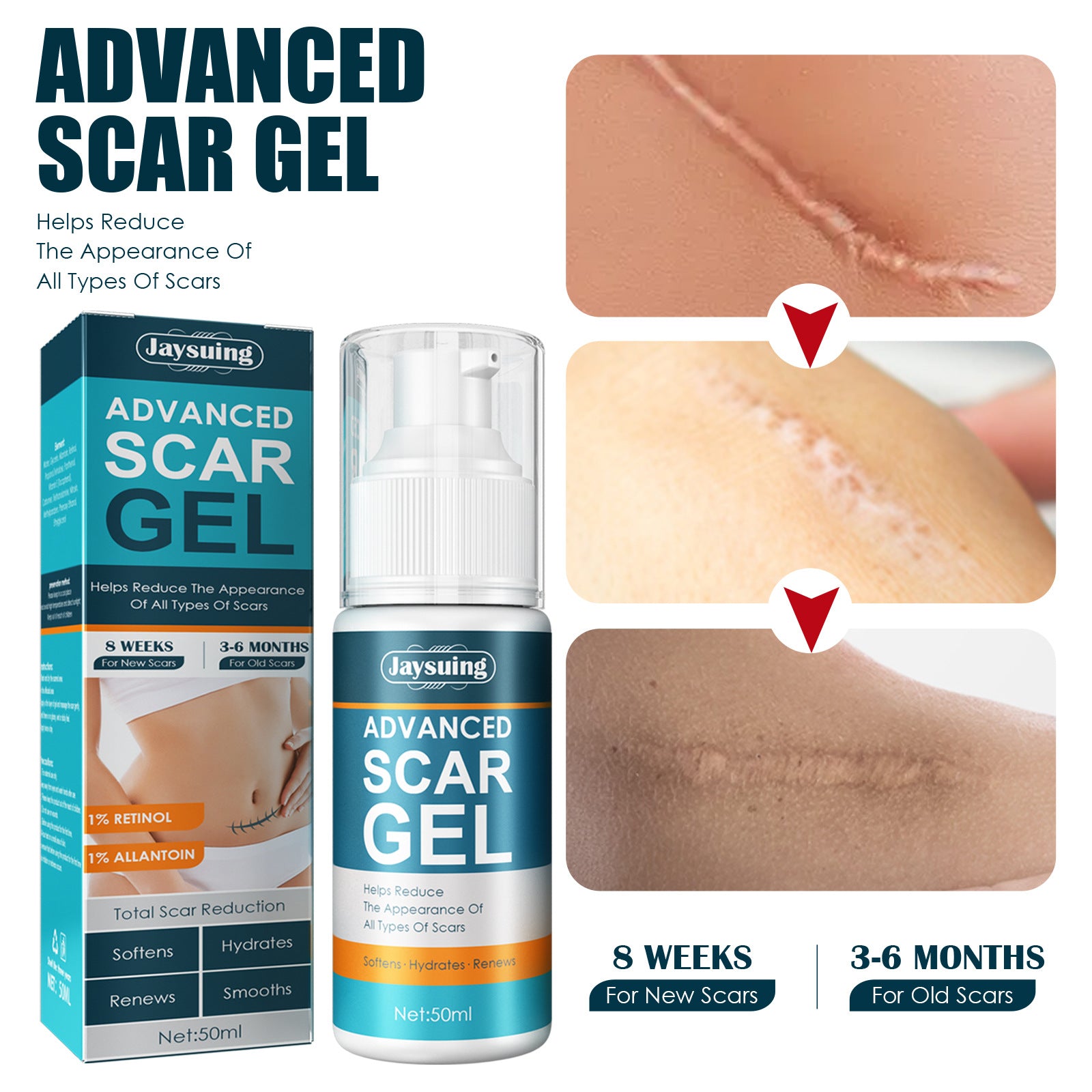 Natural Gel Improving Scar Cream Gel Skin Scar Repair Cream Postpartum Stretch Mark Scar Surgery Smooth Skin