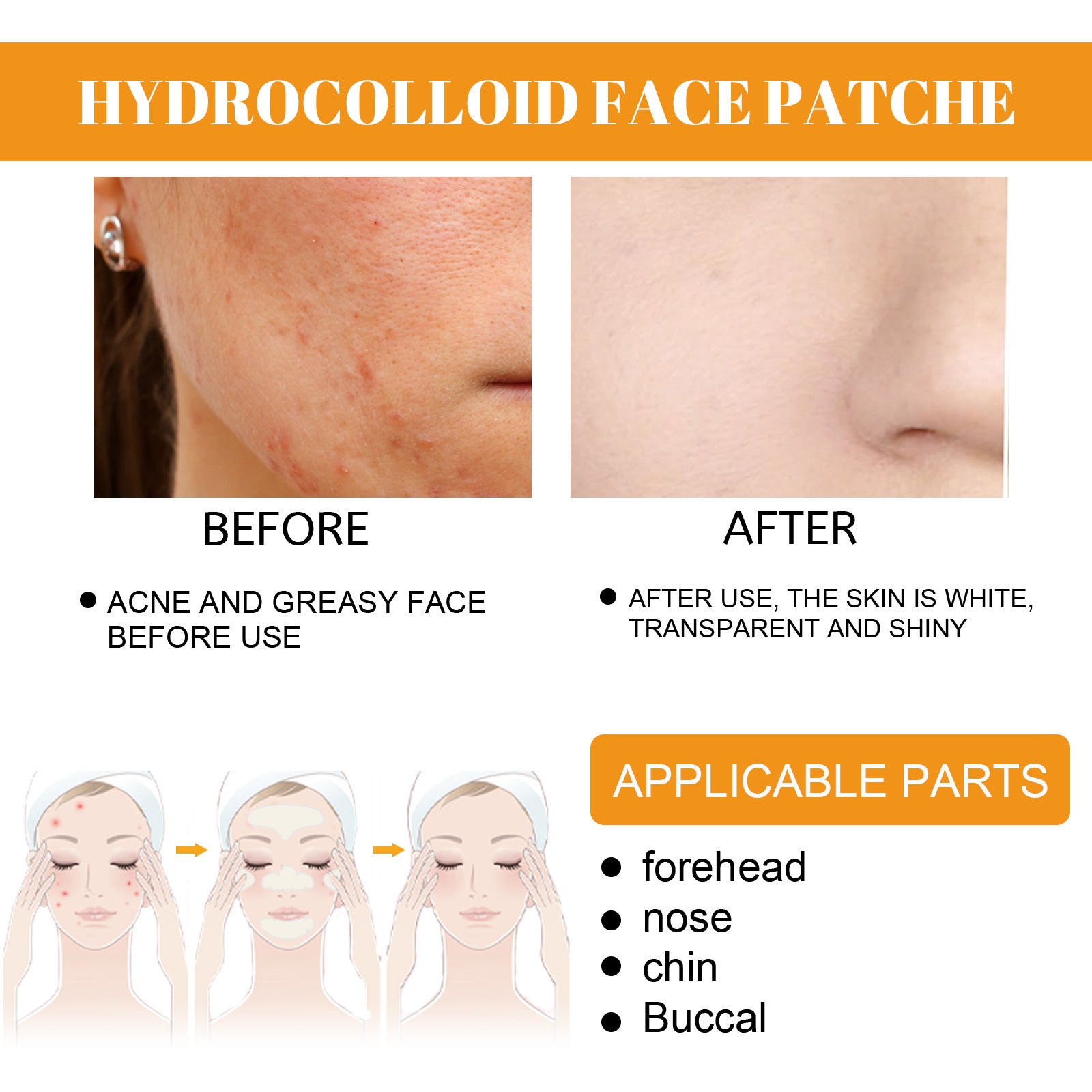 Acne EELHOE Hydrogel Facial Acne Sticker Portable Transparent Invisible Hydrogel Body Facial Care Concealer Anti-Acne Sticker