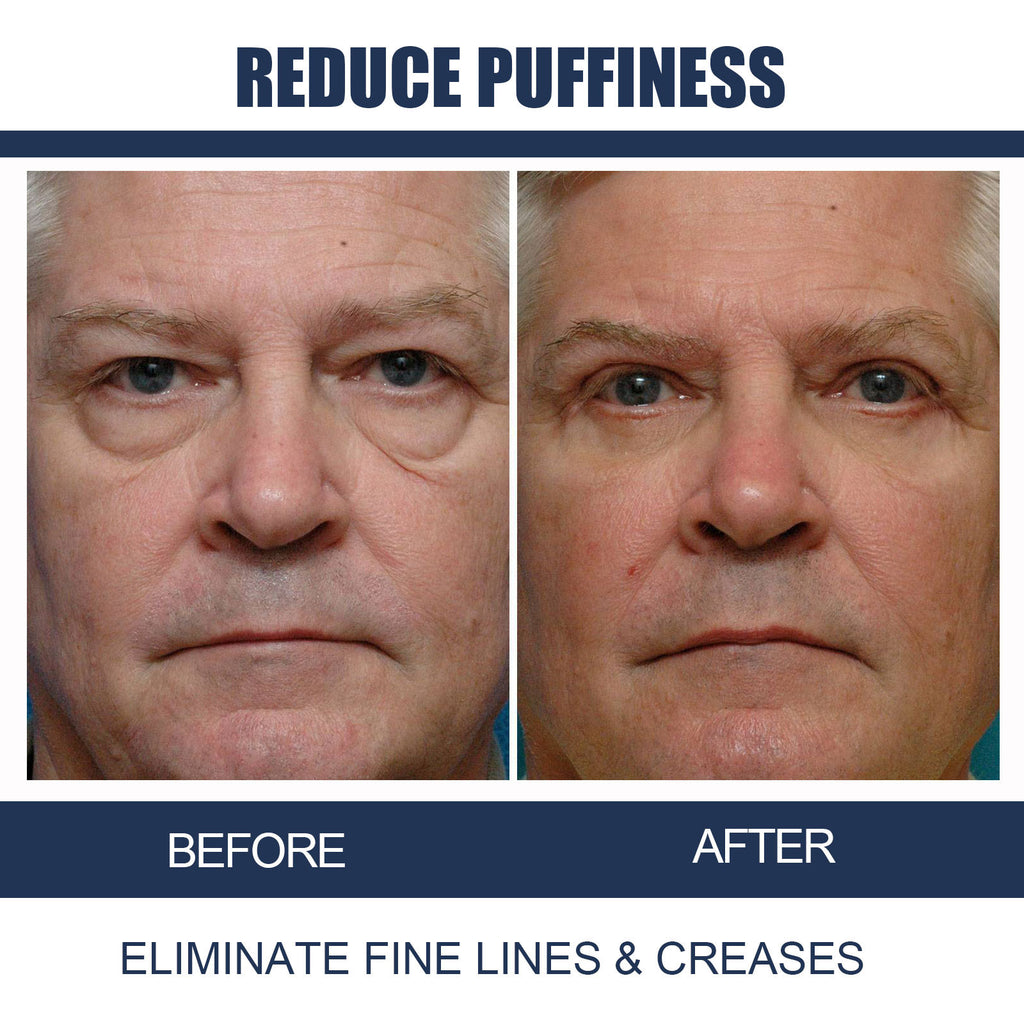 Men's Retinol Eye Cream Firming Eye Bags Dilutes Dark Circles Fine Lines Moisturizing Eye Cream