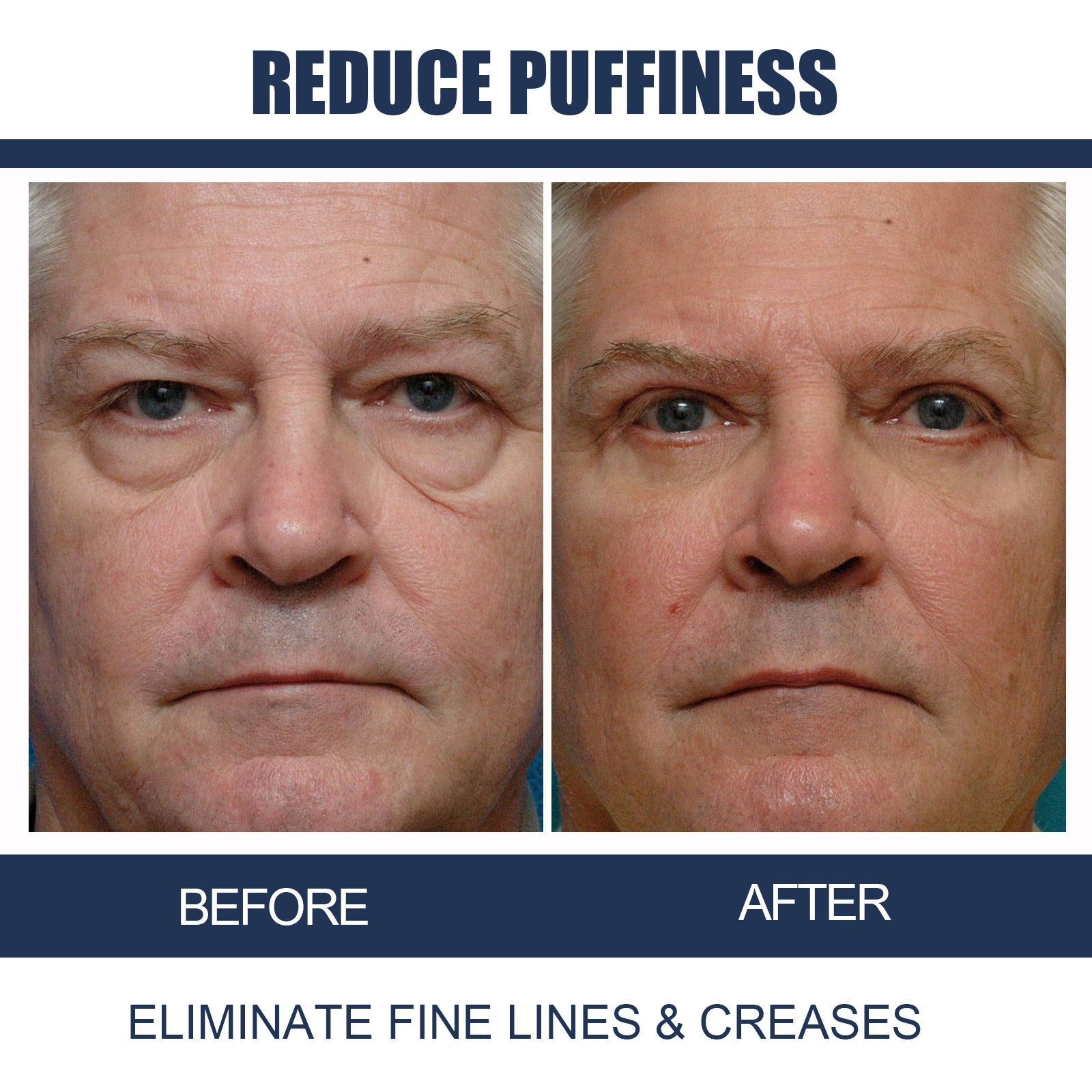 Men's Retinol Eye Cream Firming Eye Bags Dilutes Dark Circles Fine Lines Moisturizing Eye Cream