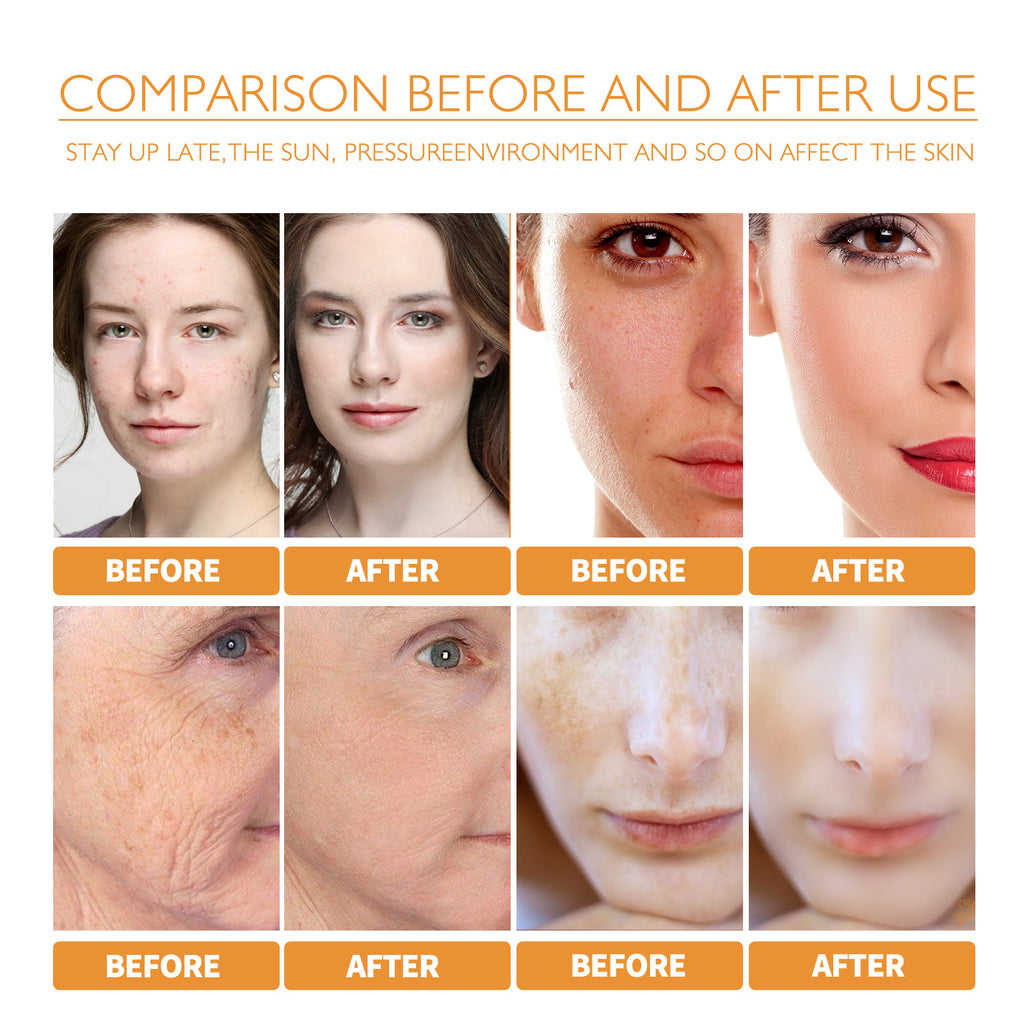 Turmeric Facial Essence: Hydrating, Fading, Spots and Acne Marks, Brightening and Nourishing Skin Essence