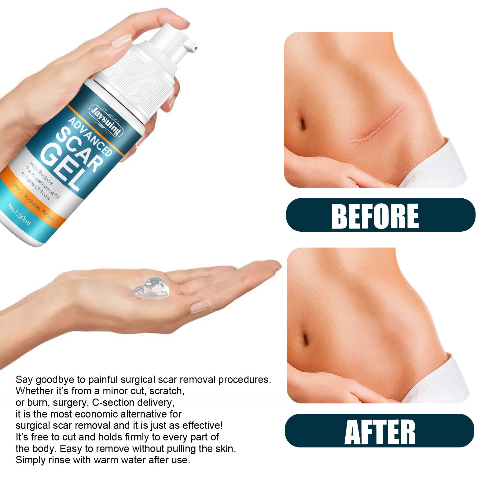Natural Gel Improving Scar Cream Gel Skin Scar Repair Cream Postpartum Stretch Mark Scar Surgery Smooth Skin