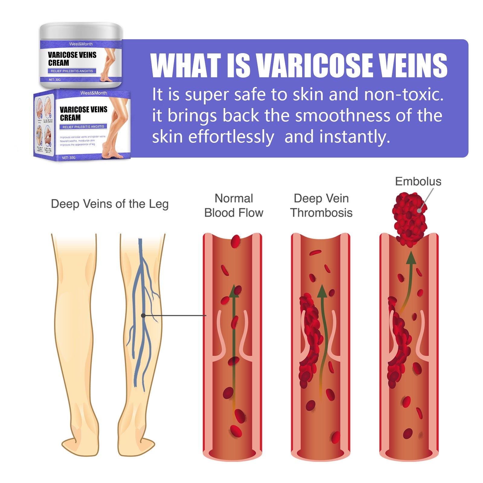 Cream vein cream earthworm leg blue veins bulge relieves pain red blood silk repair cream moisturizes legs