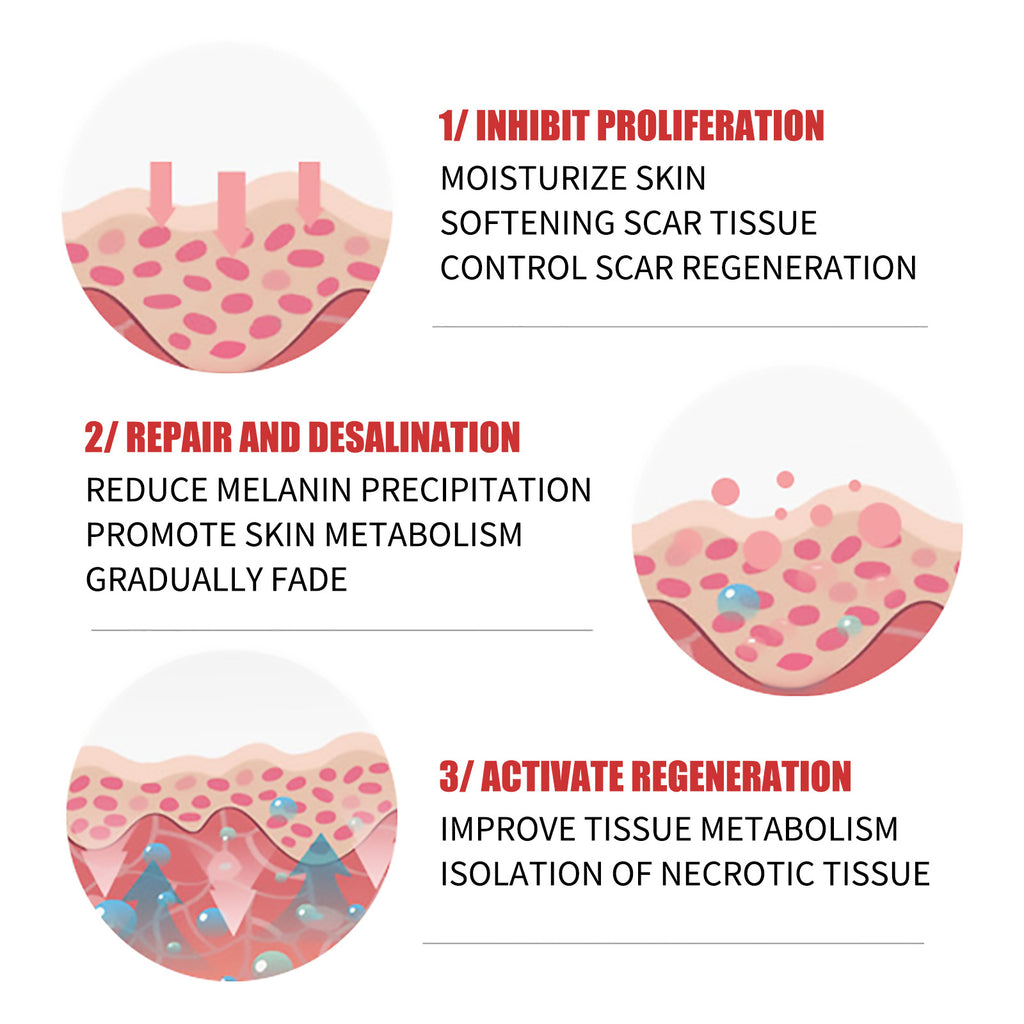 Natural cream scar repair cream scar cream fade hyperplasia pregnancy surgery burn scar skin repair