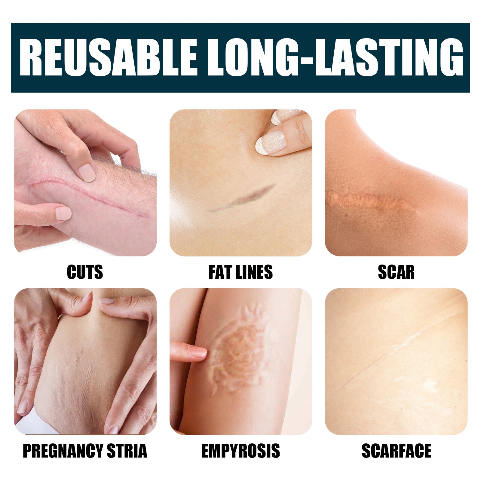 Natural Gel Improving Scar Cream Gel Skin Scar Repair Cream Postpartum Stretch Mark Scar Surgery Smooth Skin