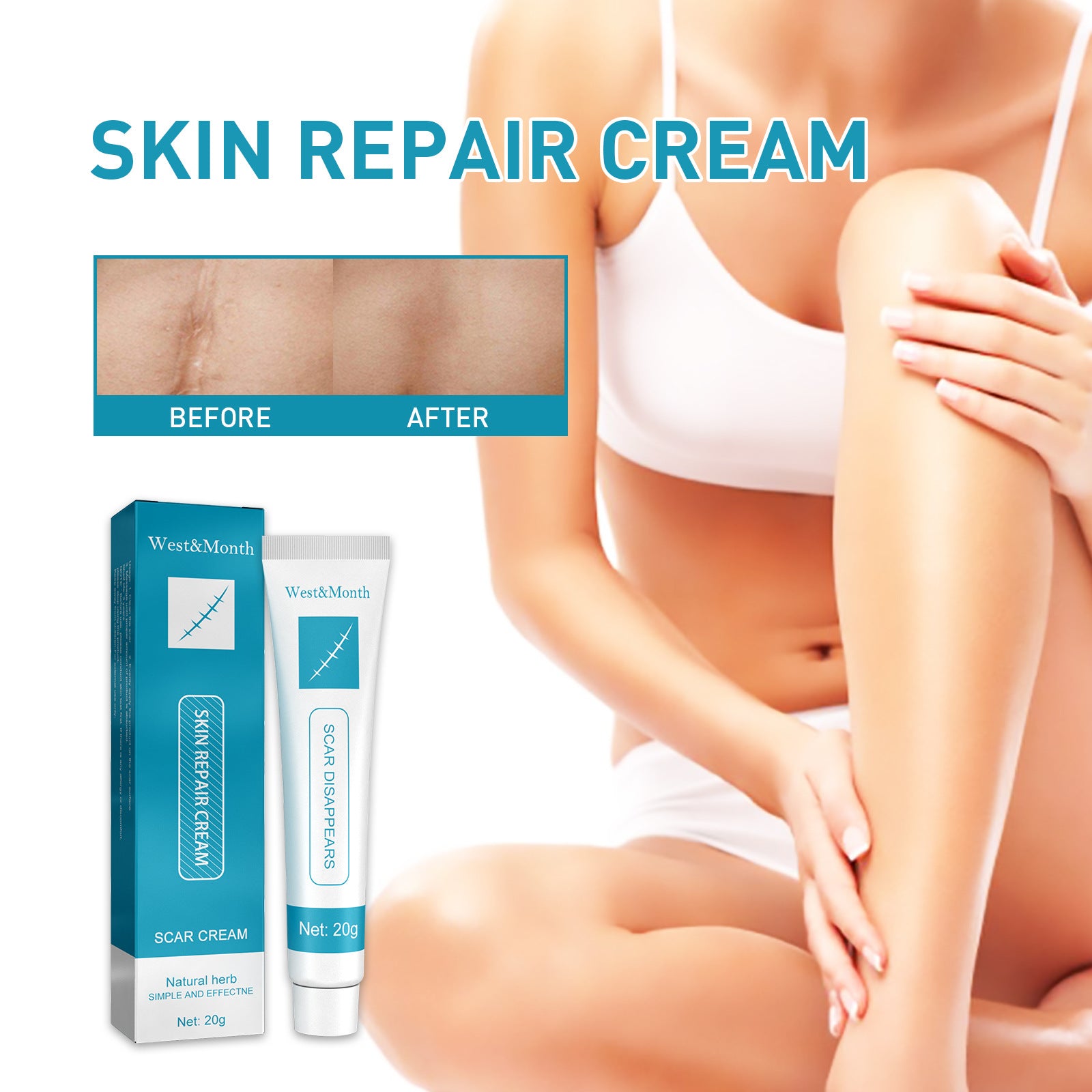 Natural cream scar repair cream scar cream fade hyperplasia pregnancy surgery burn scar skin repair