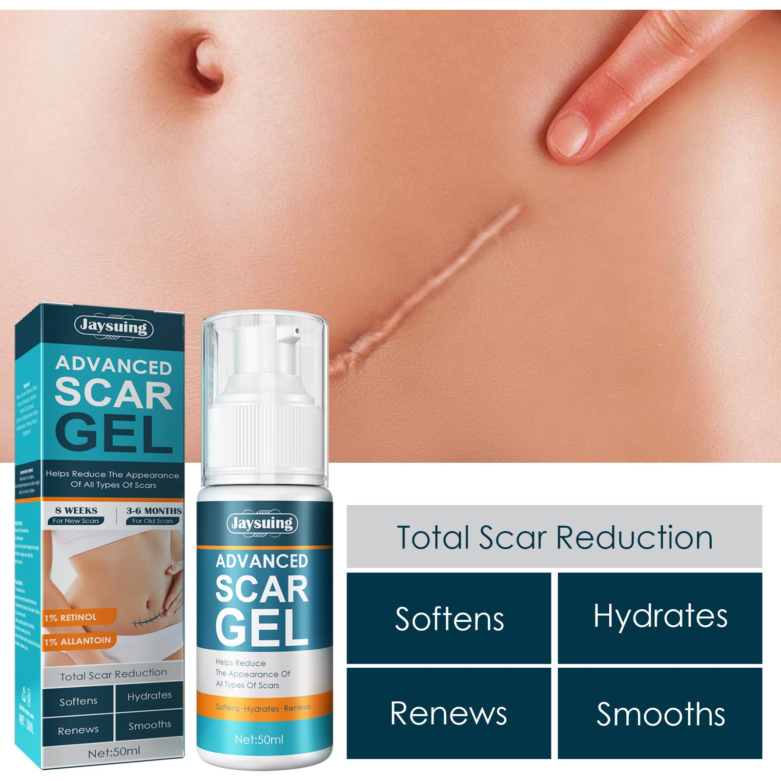 Natural Gel Improving Scar Cream Gel Skin Scar Repair Cream Postpartum Stretch Mark Scar Surgery Smooth Skin