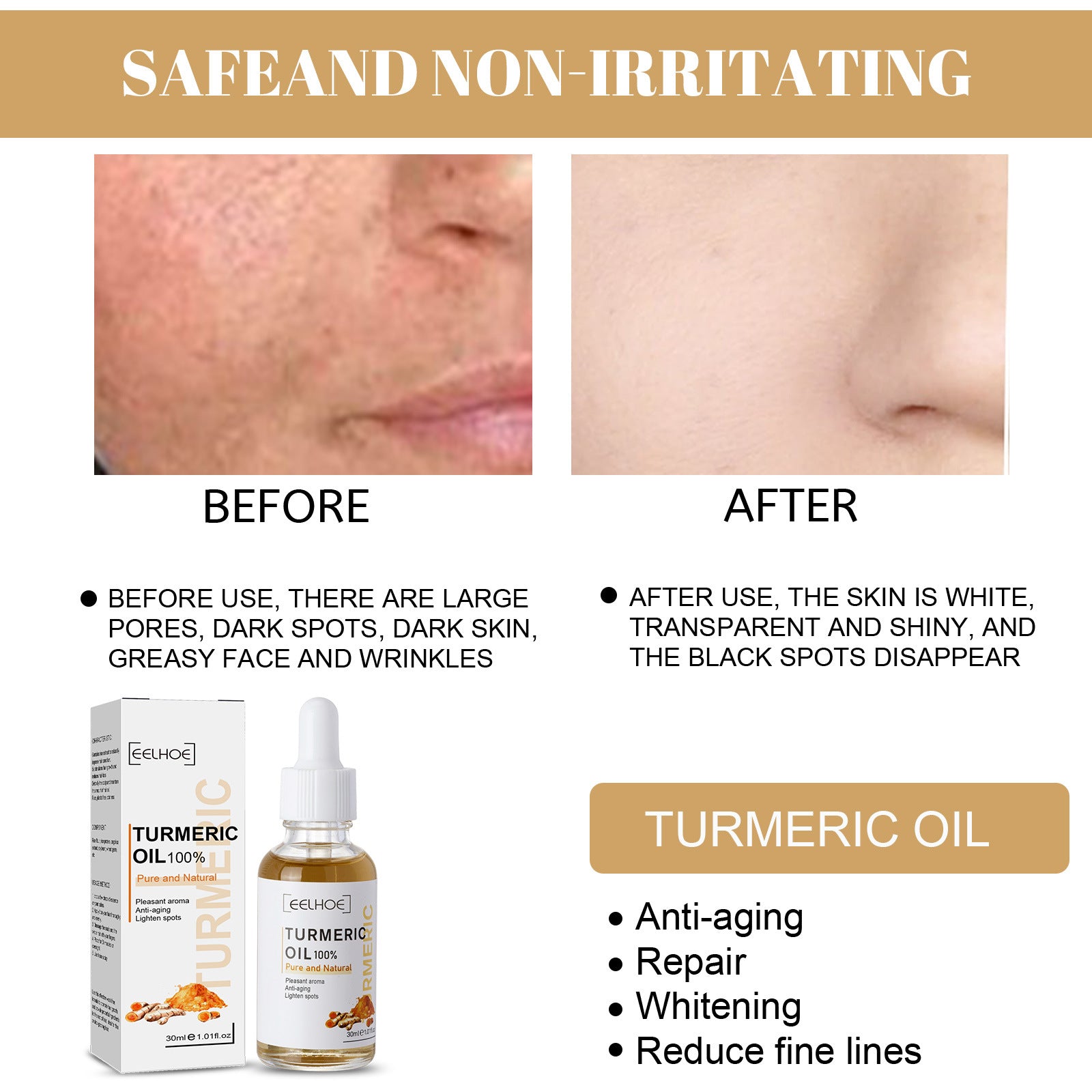 EELHOE Turmeric Dark Spot Correction Essence Facial Moisturizing Moisturizing Care Spot Improvement Skin Color Essence