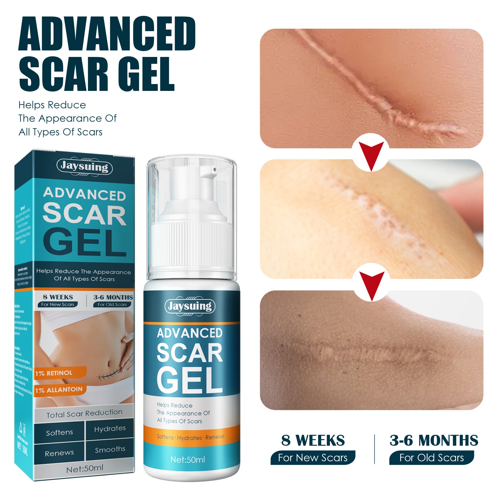 Natural Gel Improving Scar Cream Gel Skin Scar Repair Cream Postpartum Stretch Mark Scar Surgery Smooth Skin